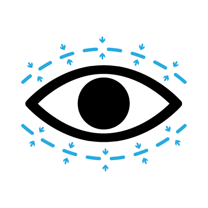 Oculoplastics